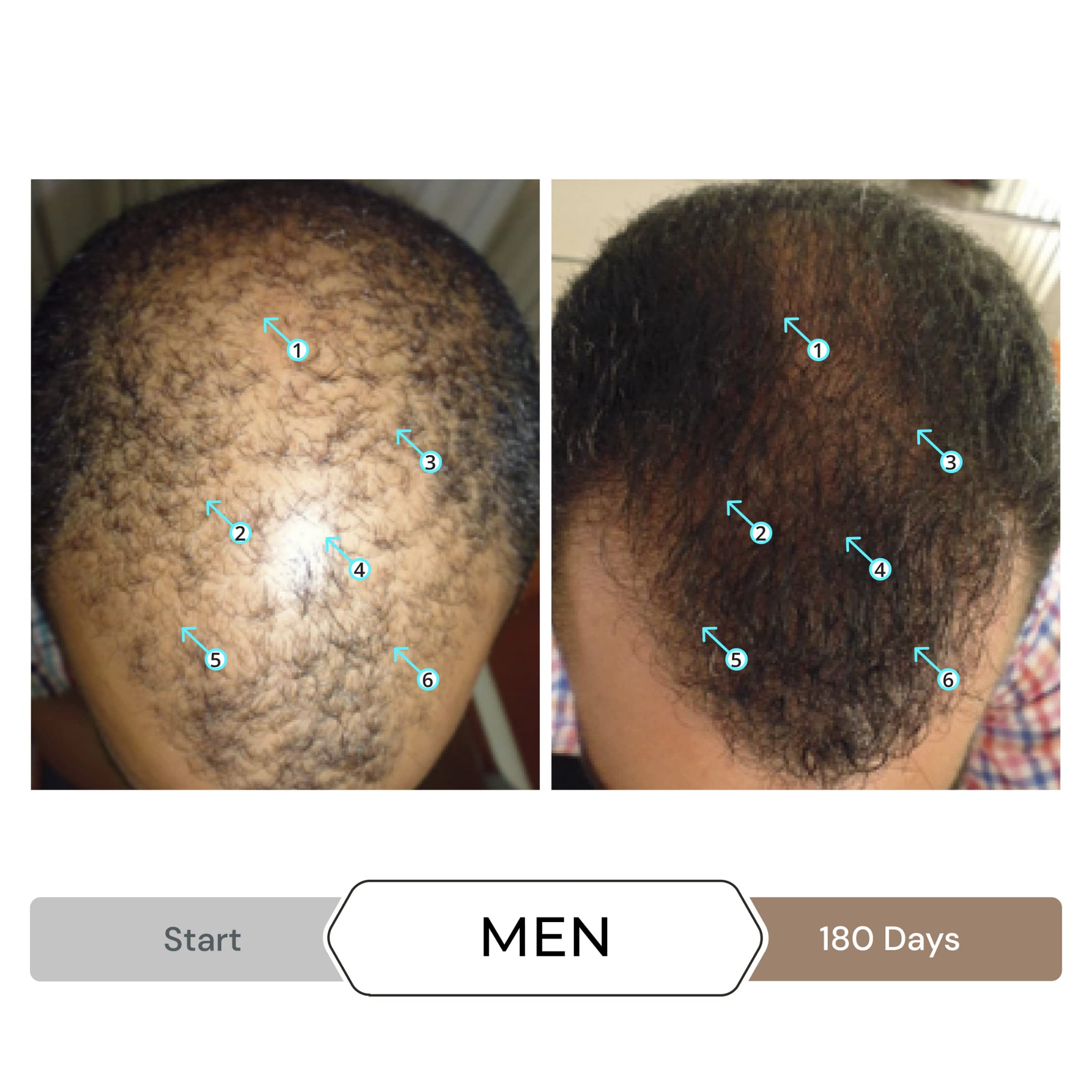 DS Labs Revita Shampoo & Spectral.DNC-N Hair Serum - Sulfate-Free Hair Thickening Shampoo & Hair Growth Treatment for Thinning Hair & Hair Loss | Clinically Proven Formula for Men & Women | Perfect for Daily Use & Scalp Care Routine