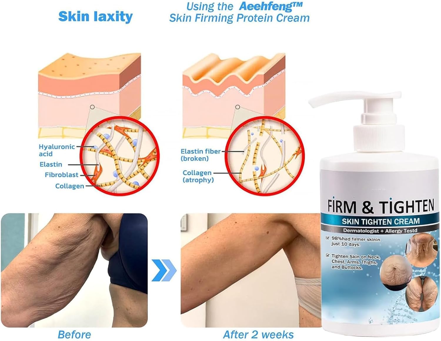 **Aeehfeng Firming Body Cream for Loose Skin - Tighten & Firm Arms, Legs & Stomach - Anti-Aging Skin Tightening Cream for Women & Men - Post-Pregnancy & Weight Loss Care**    *(Use after shower or before bed for best results to improve skin elasticity and reduce sagging.)*