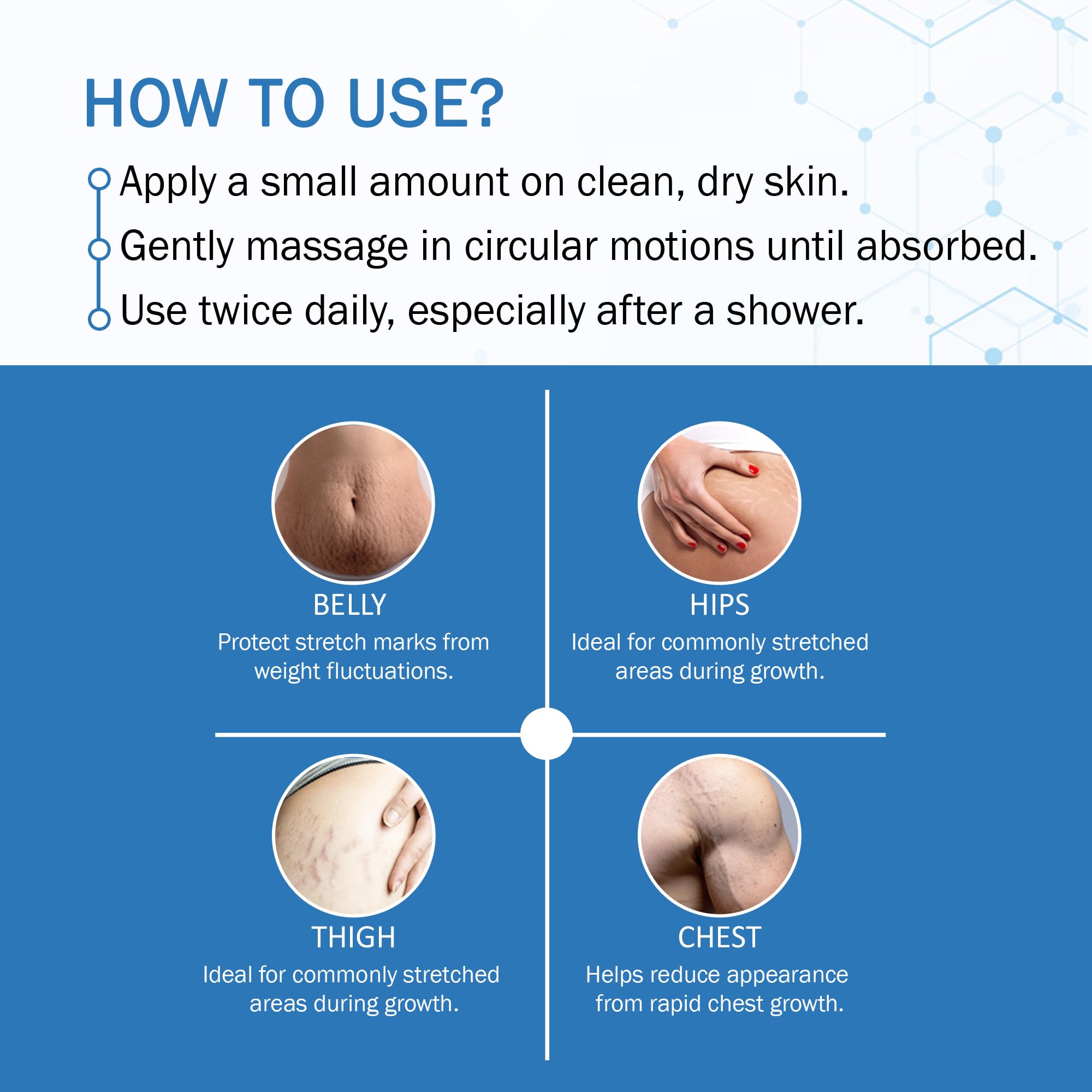 7DAYSNATURAL Pregnancy Stretch Mark Oil - Coconut & 9 Botanical Oils Blend for Elasticity & Scar Fading (30ml) | Safe for Expecting Moms & Postpartum Care | Perfect for Belly, Hips & Thighs During Pregnancy & Weight Loss