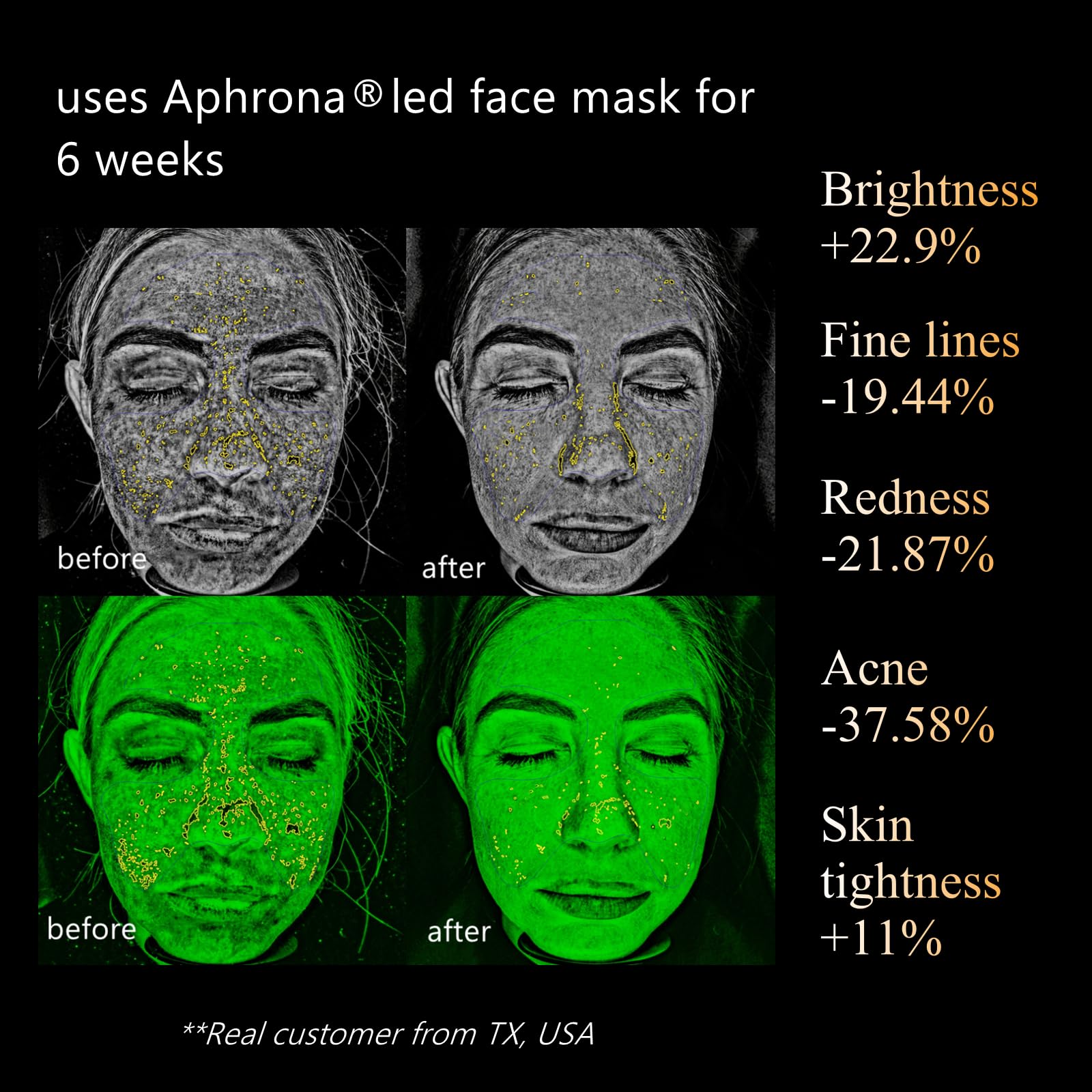 LED Face Mask Light Therapy - Blue & Red Light Photon Mask for Acne & Wrinkle Reduction, Halo LED Facial and Neck Skin Care Device | At-Home Spa Treatment & Professional Skin Rejuvenation
