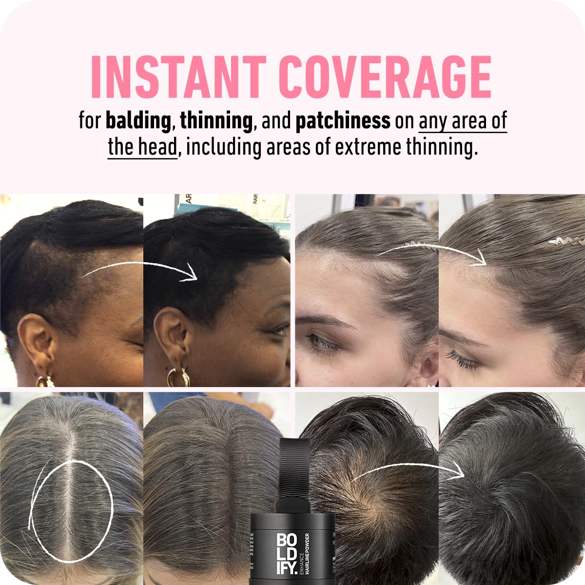 Boldify Hairline Powder & Hair Fiber Bundle - Instant Hair Loss Concealer for Thinning Hair, Root Cover Up Spray (Black) | Perfect for Daily Use, Special Occasions & Confidence Boosting