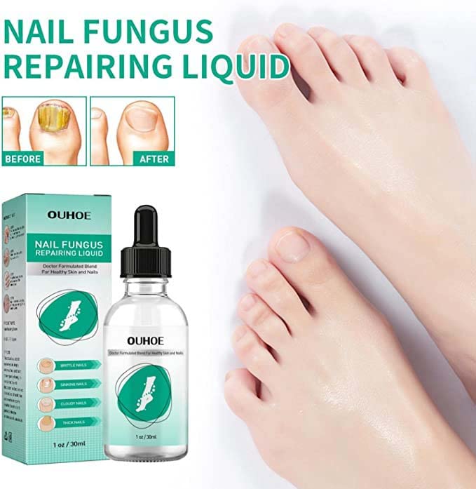 Kerassentials Toenail Fungal Treatment Oil - Extra Strong Foot & Nail Repair Kit for Fungus Relief | Athlete's Foot Care, Nail Restoration for Healthy Toes