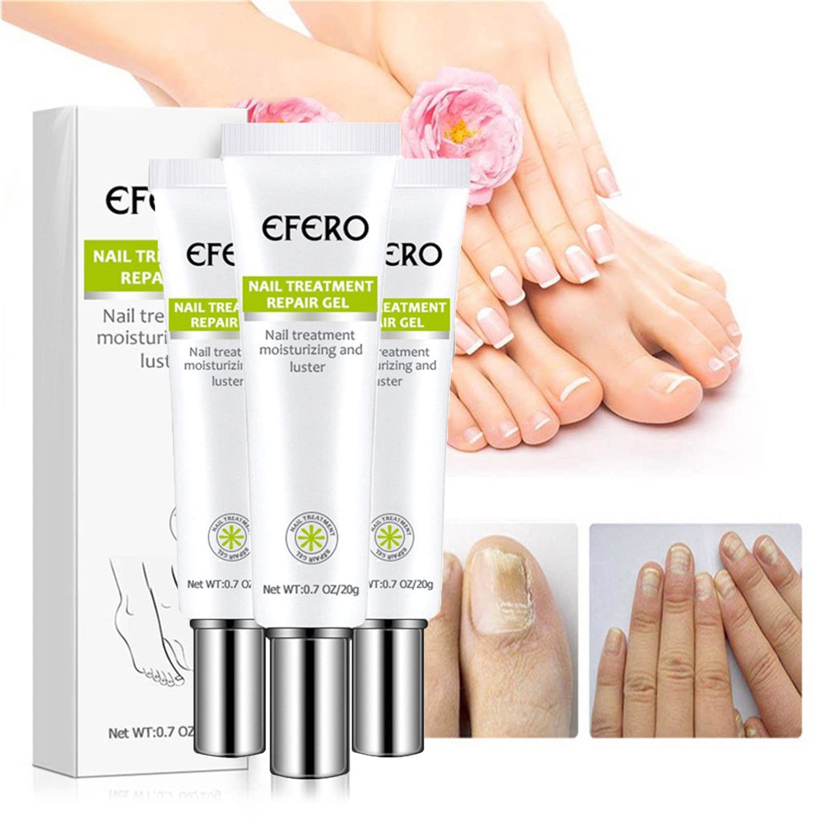 Efero Nail Repair Essence Gel - Damaged Nail Treatment & Toenail Care - Restores Discolored Nails - Instant Beauty Cream for Healthy Nails (3Pcs) - Perfect for Salon Use & At-Home Nail Care