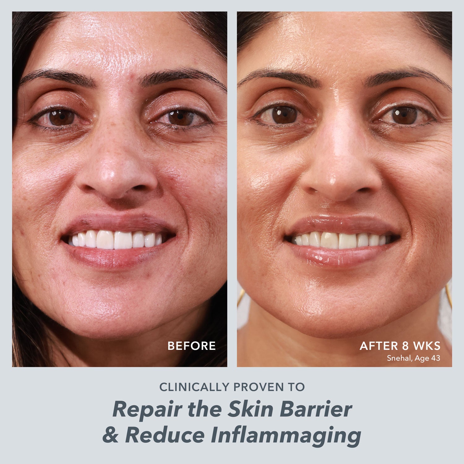 Milk RX Advanced Better Aging Cream - Anti-Wrinkle & Firming Face Moisturizer for Women - Hydrating Night Cream for Dry Skin - Perfect for Daily Skincare Routine & Anti-Aging Regimen