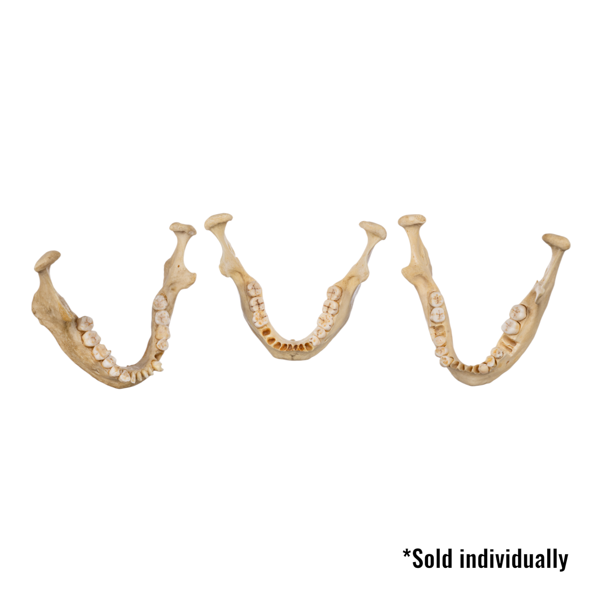 Authentic Human Mandible Bone - Single Specimen for Medical Study, Dental Education & Anatomy Research