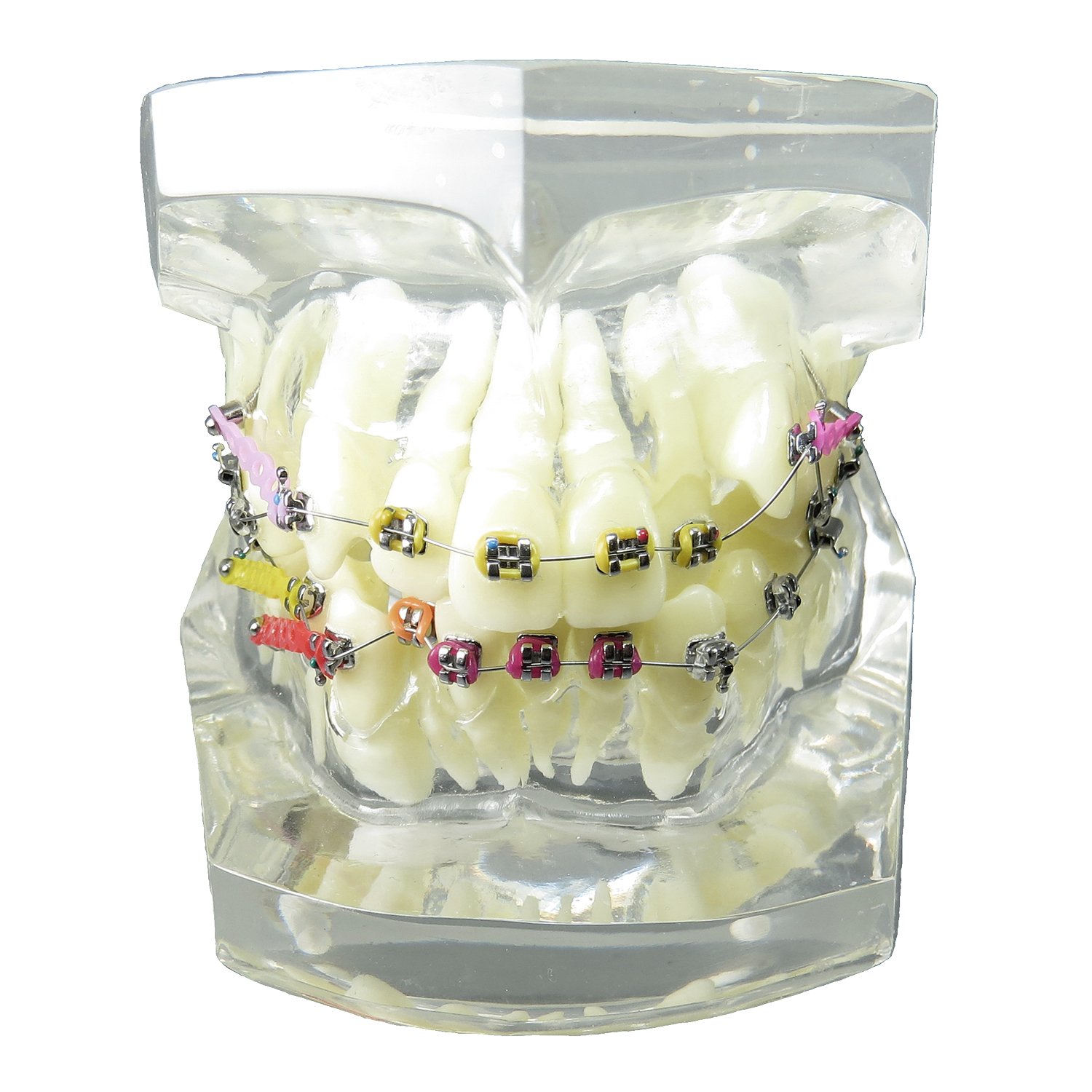 Orthodontic Teeth Model with Metal Brackets & Wires - Dental Malocclusion Treatment Kit with Colorful Ties, Chains & Hoops (M3005) - Perfect for Dental Students, Orthodontic Training & Patient Education