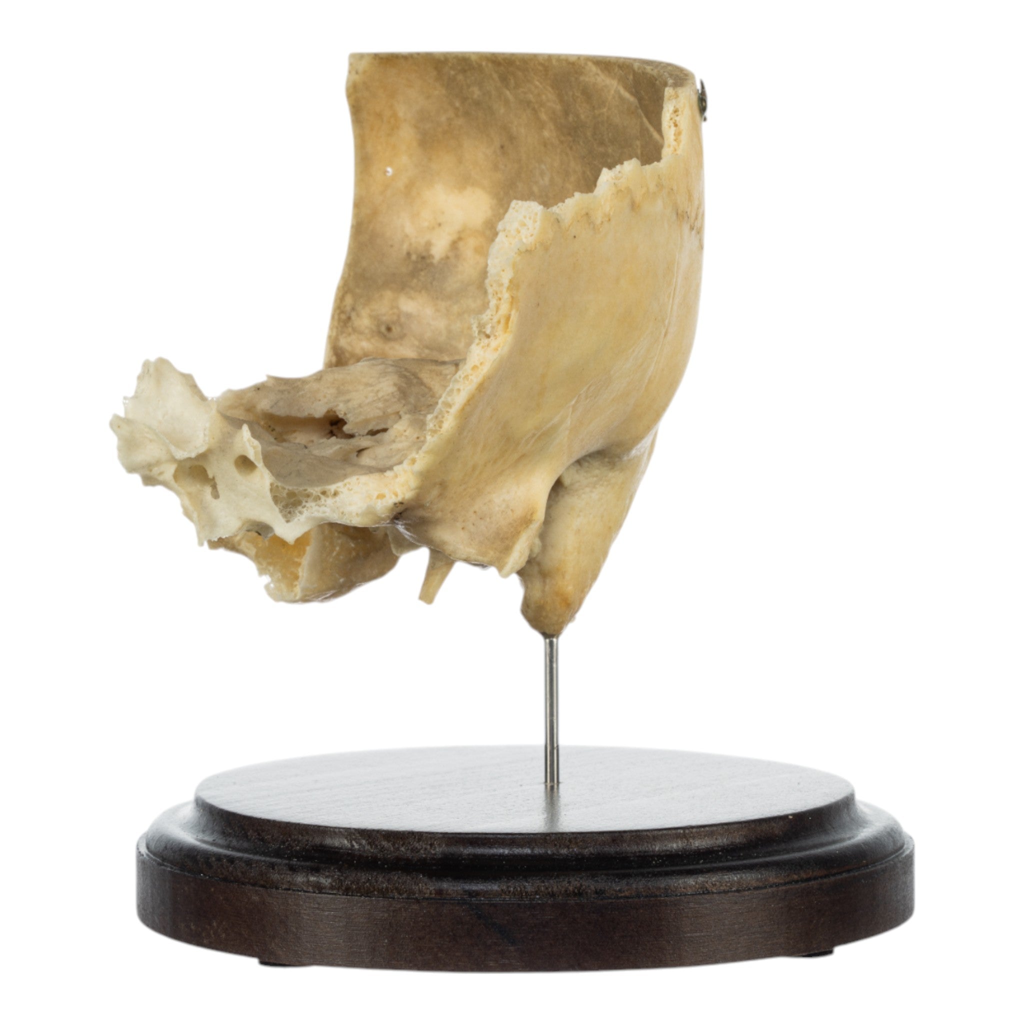 Authentic Real Human Partial Skull with Display Stand - Perfect for Medical Education, Anatomy Study & Halloween Decor