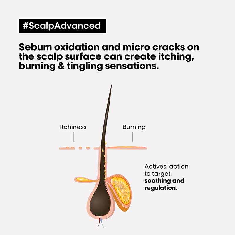 L'Oréal Professionnel Serie Expert Scalp Advanced Anti-Discomfort Dermo Regulator Shampoo - Soothes Itchy Scalp & Redness for Sensitive Scalp Care - Perfect for Daily Use & Professional Salon Treatments