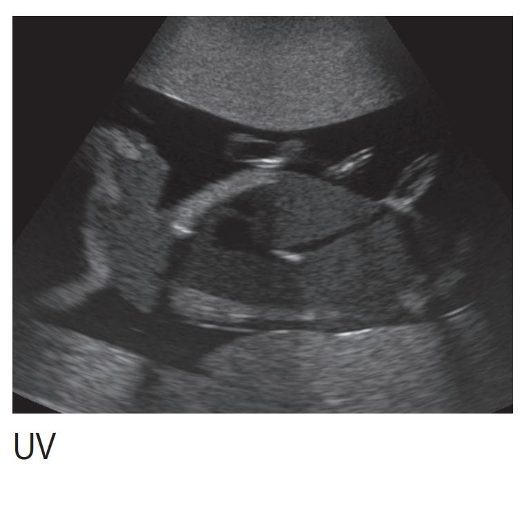 Fetal Ultrasound Training Phantom - High-Quality SPACE FAN ST Model for Medical Education & Diagnostic Practice | Perfect for OB/GYN Simulation & Sonography Training