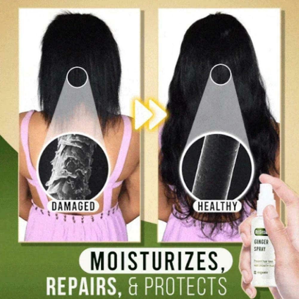 New Biotin & Ginger Hair Growth Serum - Fast Regrowth Treatment with Natural Ingredients for Thicker, Fuller Hair - Perfect for Thinning Hair, Hair Loss & Scalp Care