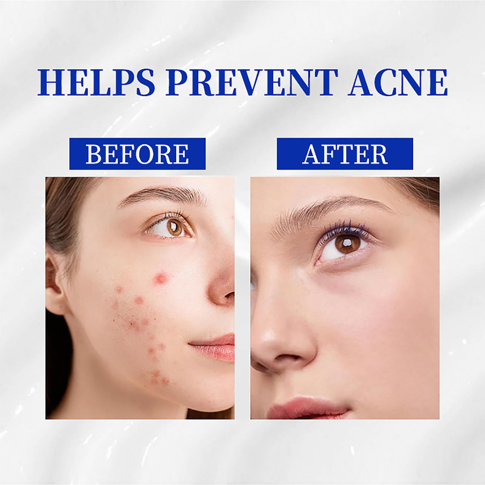 A313 Vitamin A Retinol Cream - Anti-Aging Night Cream for Pore Cleansing & Wrinkle Reduction - Best for Dry, Sensitive & Mature Skin - Perfect for Nighttime Skincare Routine & Hydration Boost