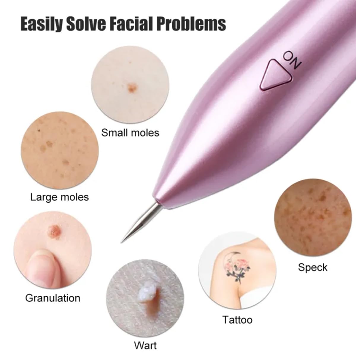 Professional Mole & Spot Remover Pen - Fast & Painless Skin Tag Removal for Face & Body - Perfect for Home Use & Travel Skincare