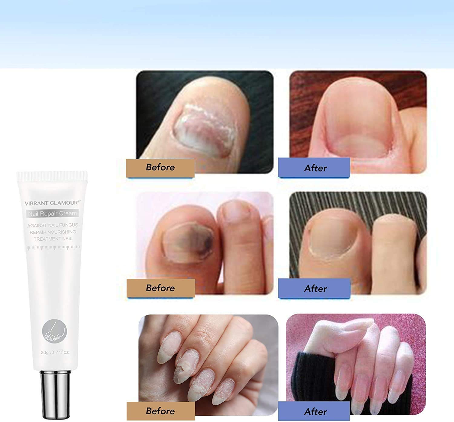 Vibrant Glamour Nail Repair Cream - Strengthening & Hydrating Treatment for Damaged Nails (1pc) | Perfect for Dry, Brittle Nails & At-Home Manicures