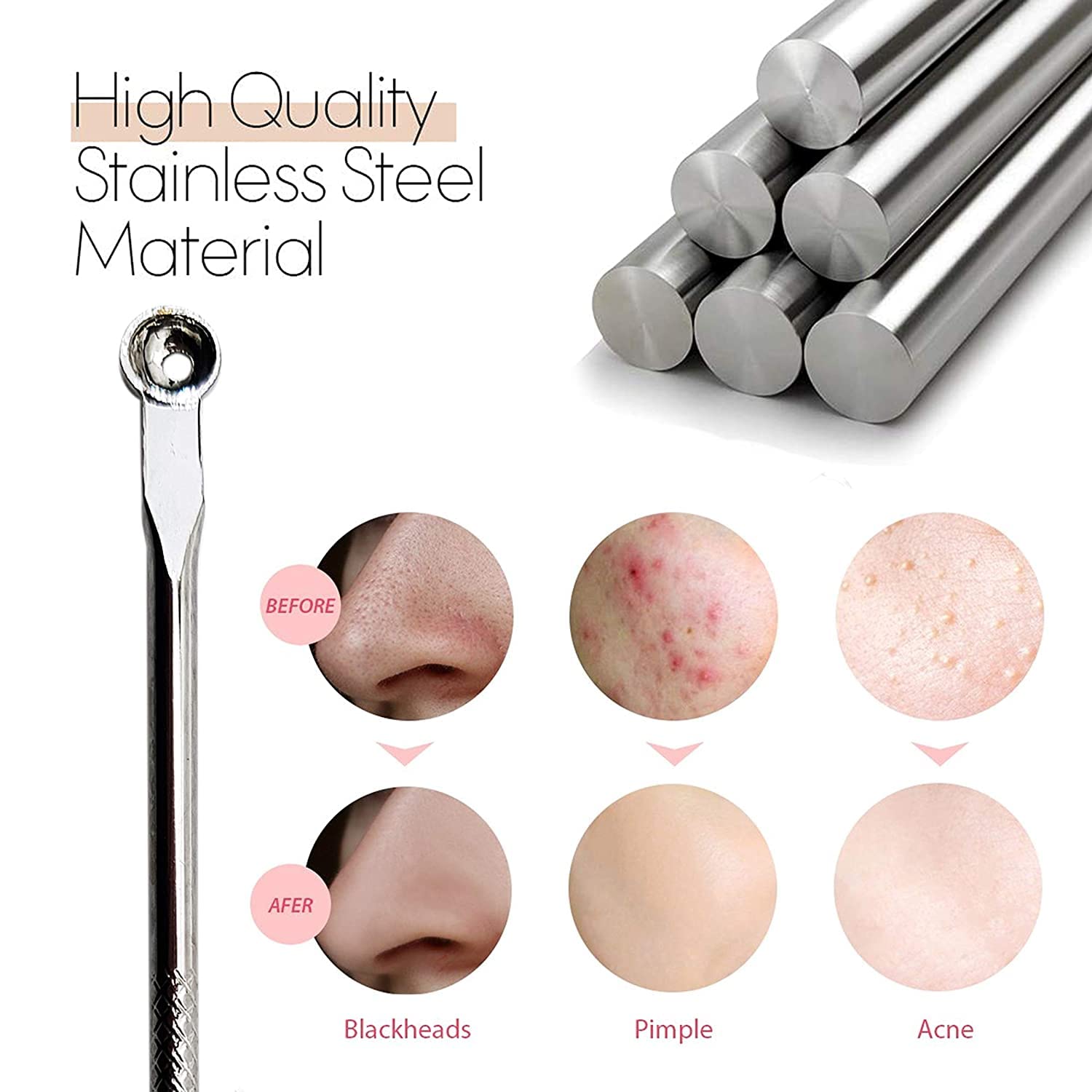 TRIPLC Moolyavaan Blackhead & Whitehead Remover Tool - 2-in-1 Pimple Popper, Milia & Pus Extractor Set (Pack of 2) - Perfect for Facial Care, Acne Treatment & Skin Blemish Removal at Home
