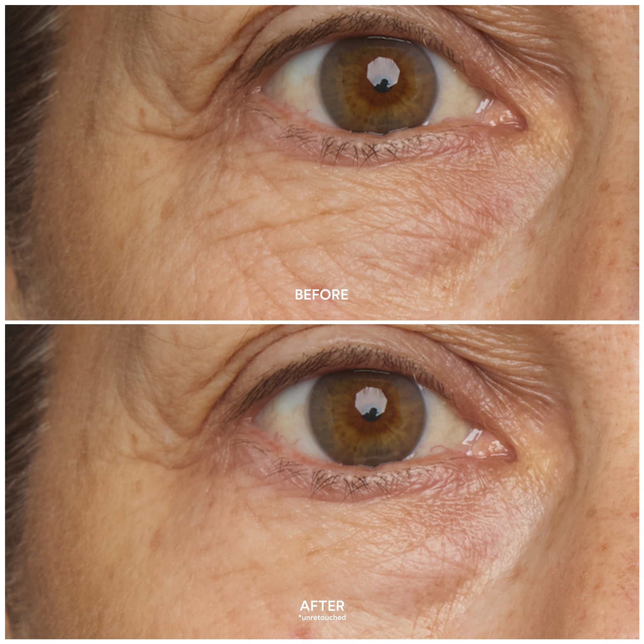Chebula Multi Corrective Eye Patches for Dark Circles, Puffiness & Wrinkles | Anti-Aging Under Eye Treatment | Perfect for Night Routine & Travel Skincare