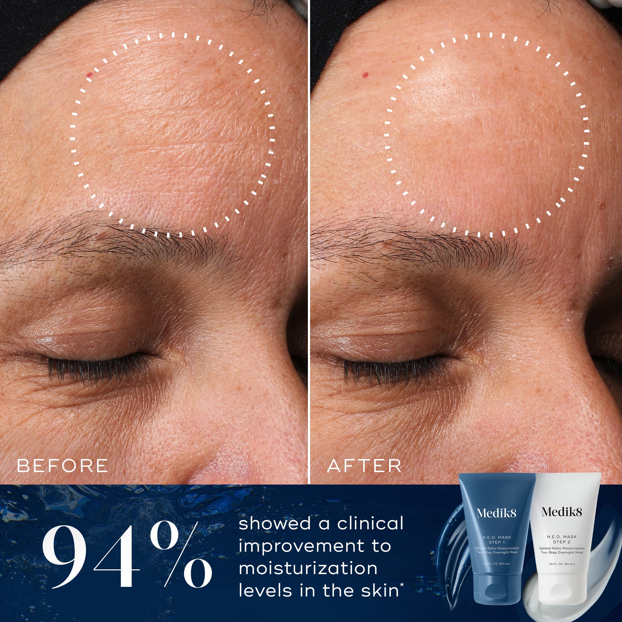 HEO Mask - Reusable Face Mask with Adjustable Ear Loops for Comfort & Protection - Perfect for Travel, Work, and Daily Activities