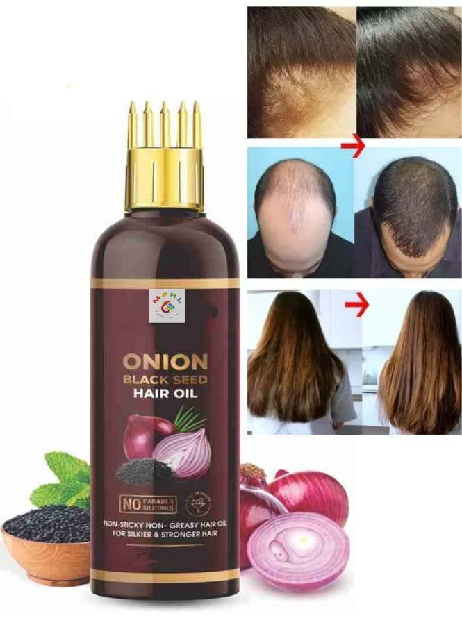 MFHL Onion Black Seed Hair Oil for Hair Growth & Thickness - Comb Applicator Included - Promotes Healthy Scalp & Stronger Hair - Perfect for Daily Hair Care & Styling
