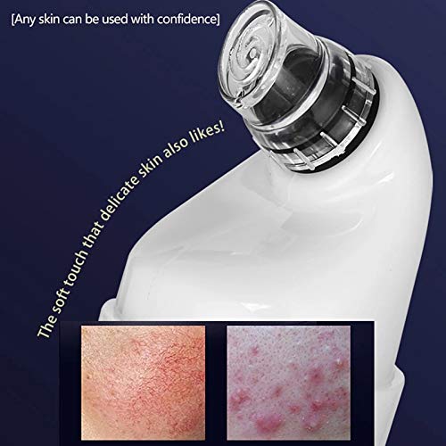 Electric Blackhead Remover & Pore Cleaner - Water Circulation Vacuum for Deep Cleansing, Acne Removal & Pore Shrinking | Perfect for Home Facial Care & Skin Treatment