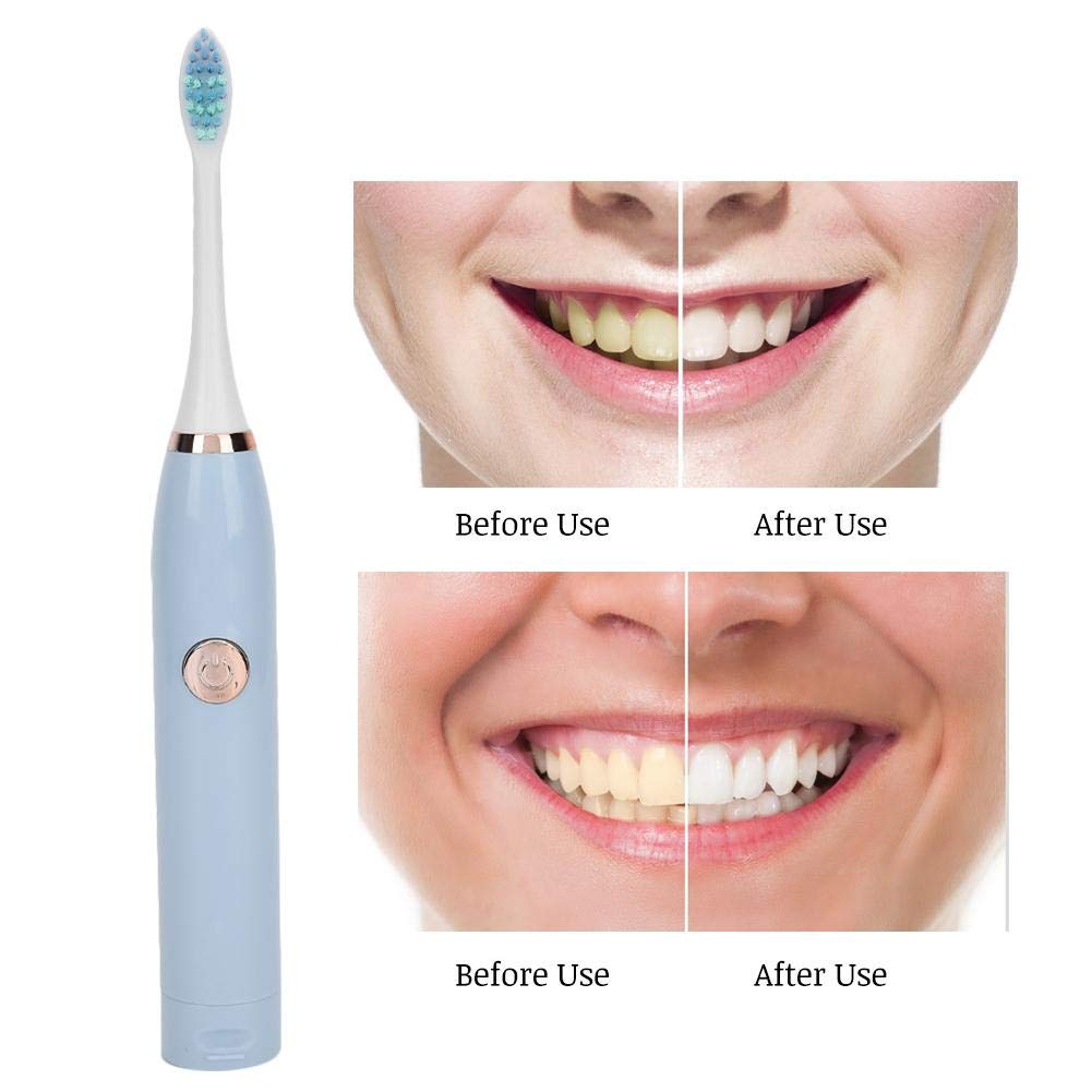 Electric Sonic Toothbrush with 5 Speed Modes - Waterproof Soft Bristles for Sensitive Teeth & Gums - Rechargeable Adult Electric Toothbrush (Blue) - Perfect for Travel, Home & Daily Oral Care