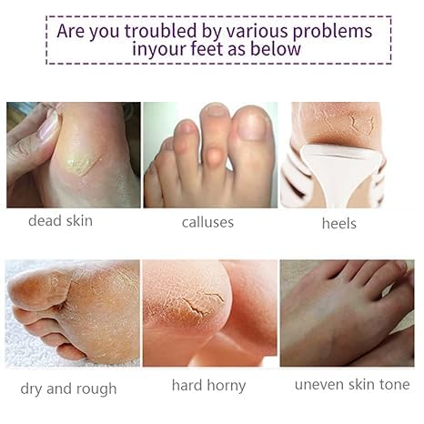 ADBHUTANAND Natural Foot Peeling Mask - Exfoliating Treatment for Dry Skin, Callus & Cracked Heels | Dead Skin Removal | Baby Soft Smooth Feet | 1 Count | Perfect for Pedicures & At-Home Foot Care