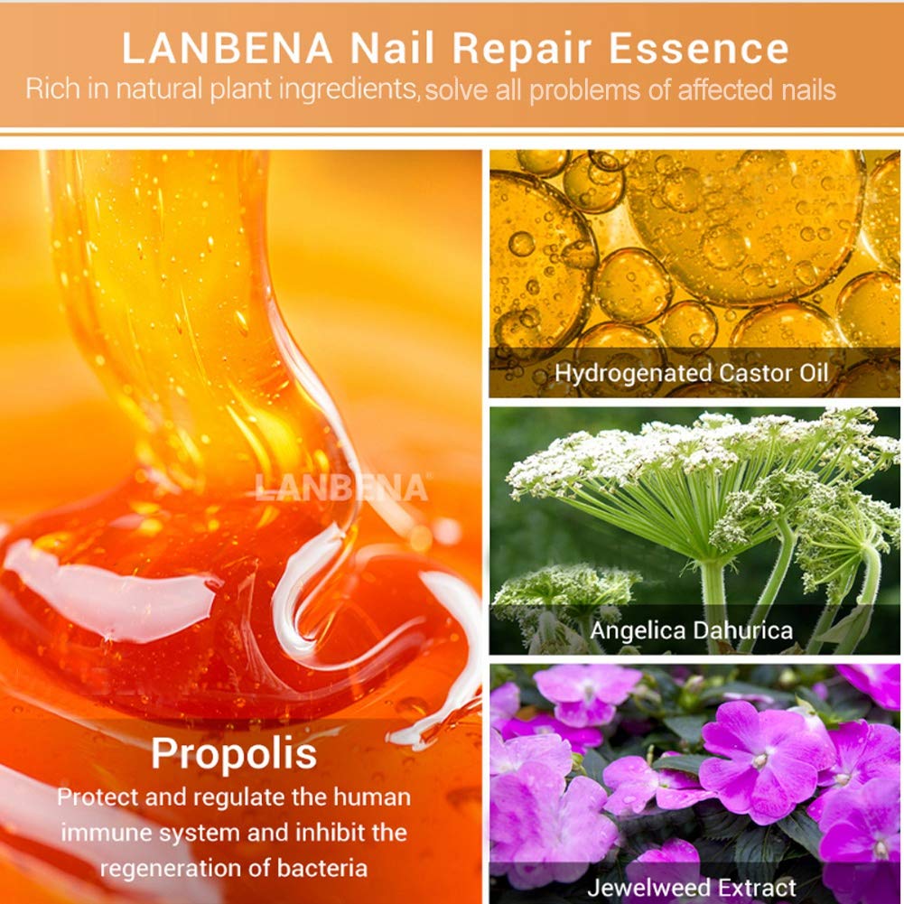 12ml Nail Repair Essence Set - Powerful Nail Strengthener & Cuticle Treatment with Nail File | Professional Nail Care Kit for Damaged, Weak & Brittle Nails | At-Home Salon Treatment & DIY Manicure Solution