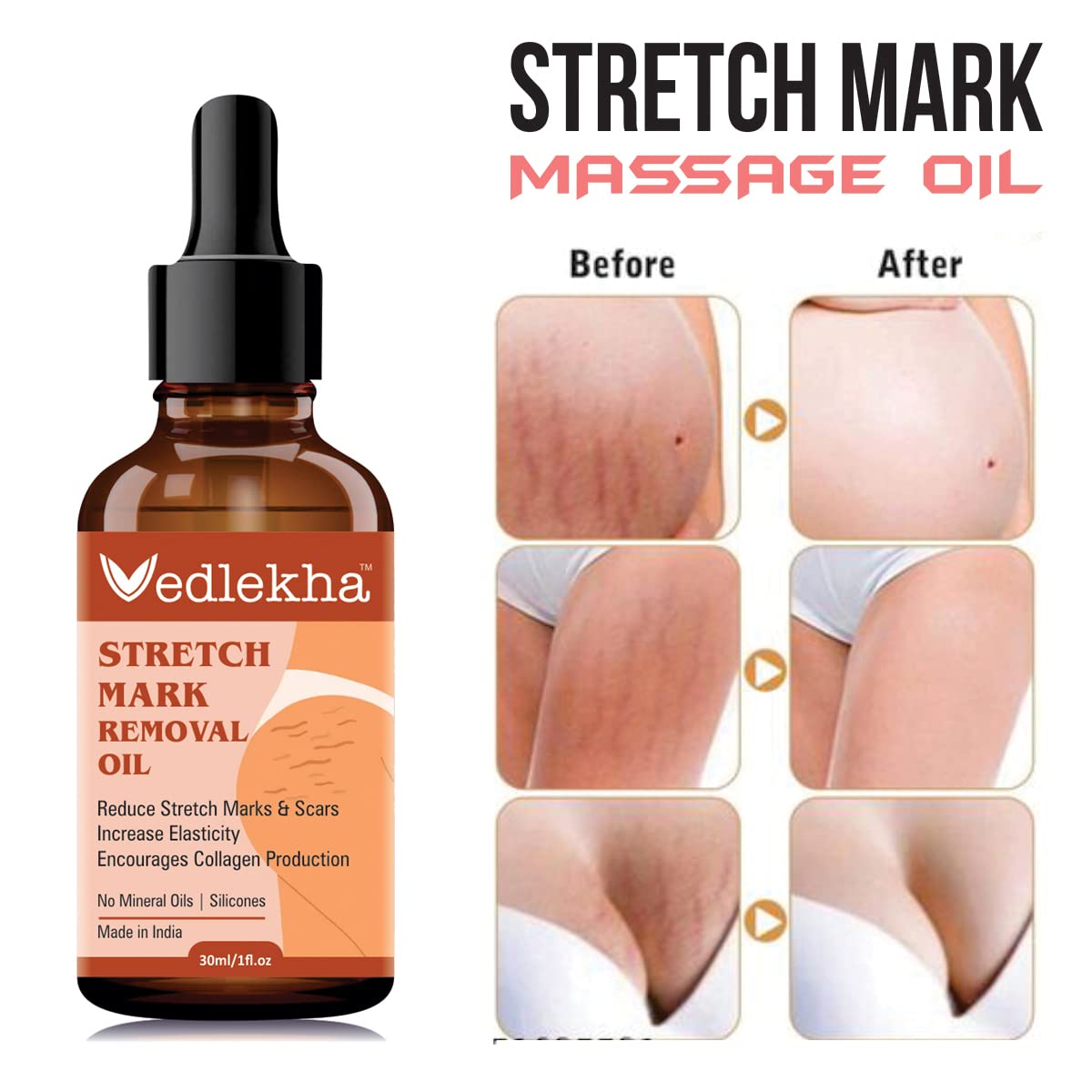 Vedlekha 7-in-1 Natural Stretch Mark Oil for Pregnancy - Clinically Proven, Toxin-Free Belly Oil (30ml) - Best for Maternity Skincare & Postpartum Recovery