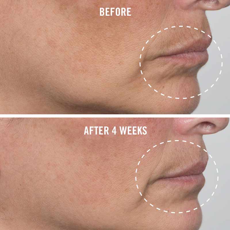 First Aid Beauty Ultra Repair Firming Collagen Cream - Anti-Aging Face Moisturizer for Dry Skin - Day & Night Cream for Wrinkles & Fine Lines - Perfect for Daily Skincare Routine & Travel