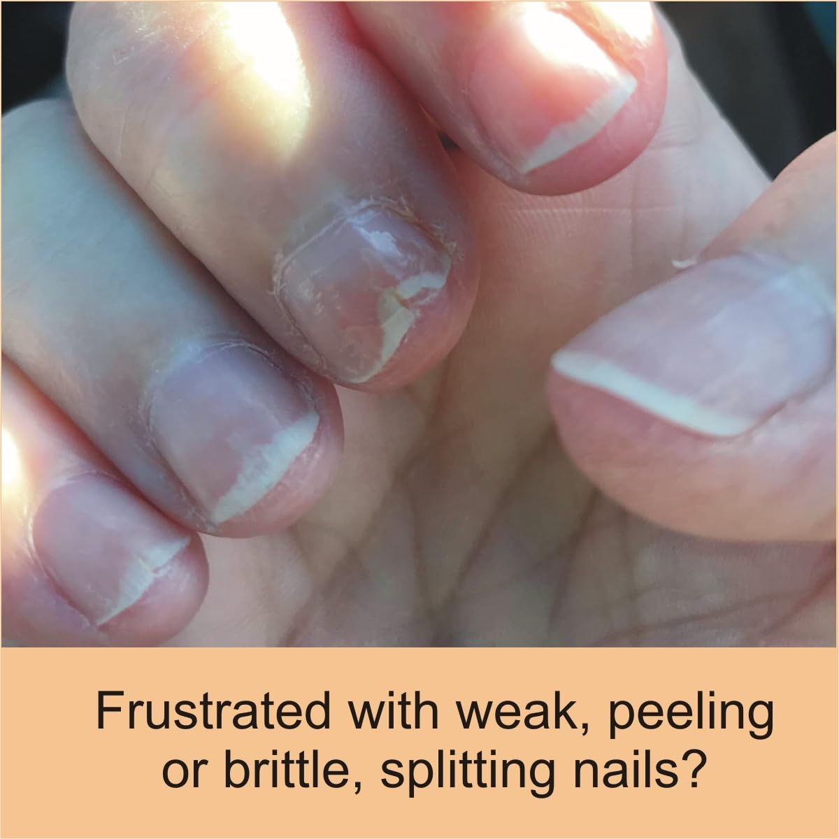 Premium Nail Strengthener & Cuticle Conditioner for Weak, Peeling, Brittle, and Cracking Nails - FlexiNail Formula for Stronger, Healthier Nails | Perfect for Manicures, Nail Care Routine & Daily Hydration