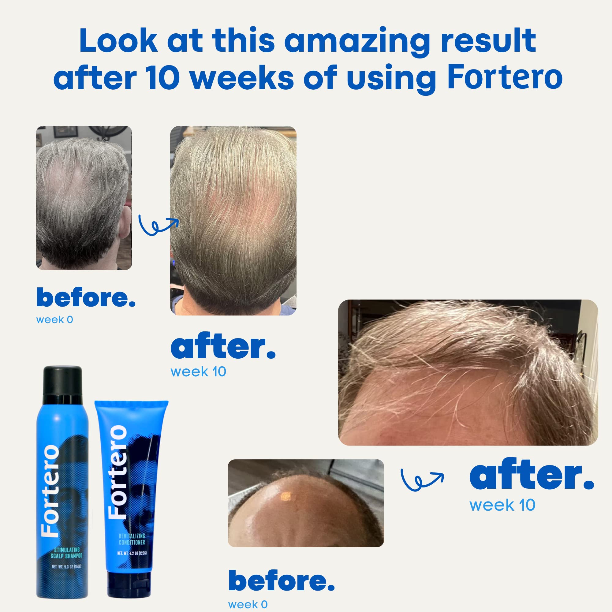 Fortero Hair Growth Conditioner - Thickening & Moisturizing Treatment for Thinning Hair - Sulfate Free & Keratin Enriched (3 Pack) - Perfect for Daily Use & Damaged Hair Repair