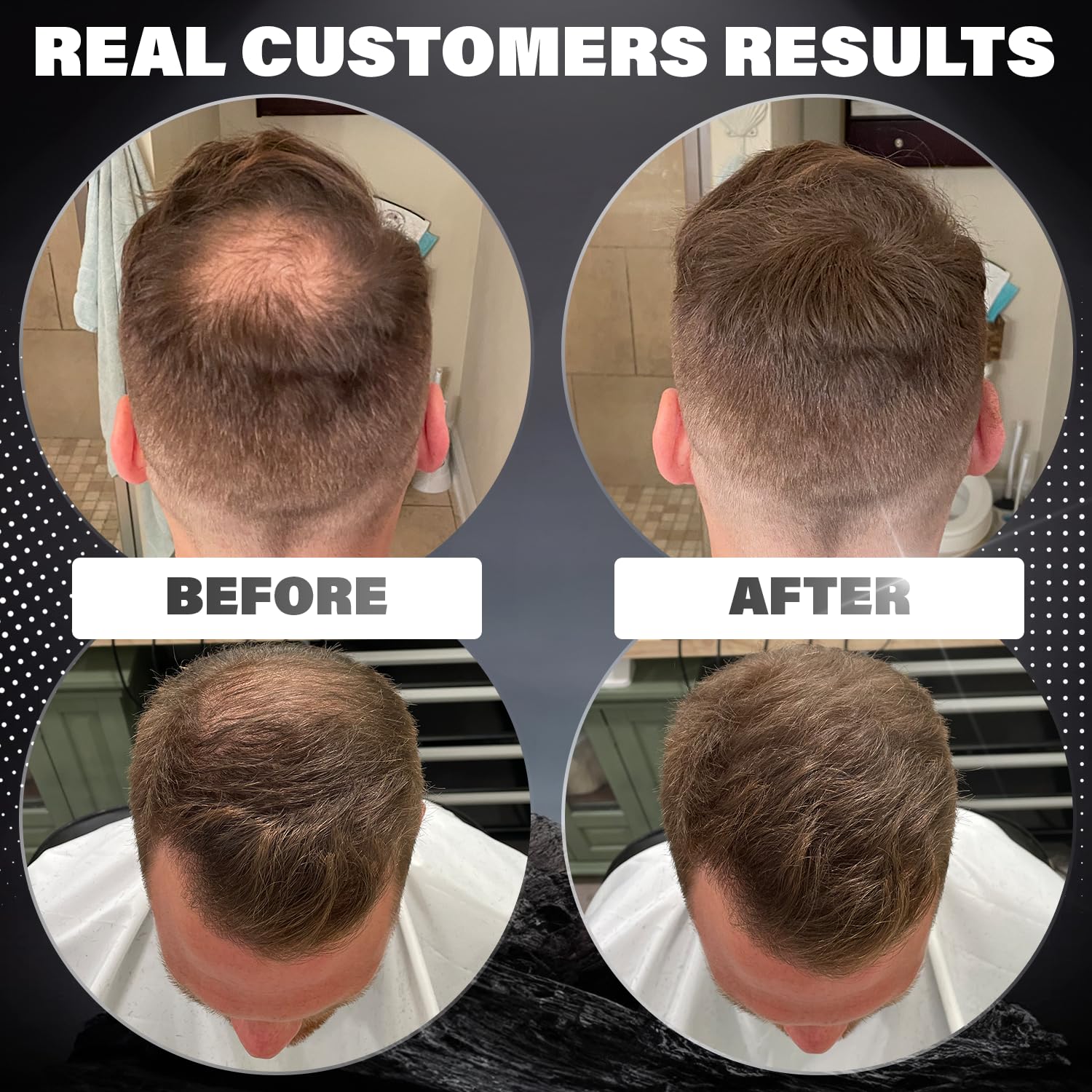 Dark Brown Hair Fibers for Thinning Hair - 100% Natural Undetectable Hair Building Powder for Men & Women | Conceals Bald Spots & Hair Loss | 2 Month Supply | Perfect for Daily Use, Work, and Social Events