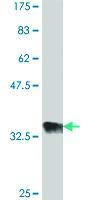 Anti-EPC1 Mouse Polyclonal Antibody (50µl) - High-Quality Research Antibody for Western Blot, Immunoprecipitation & Immunofluorescence - Ideal for Cancer Research & Epigenetic Studies