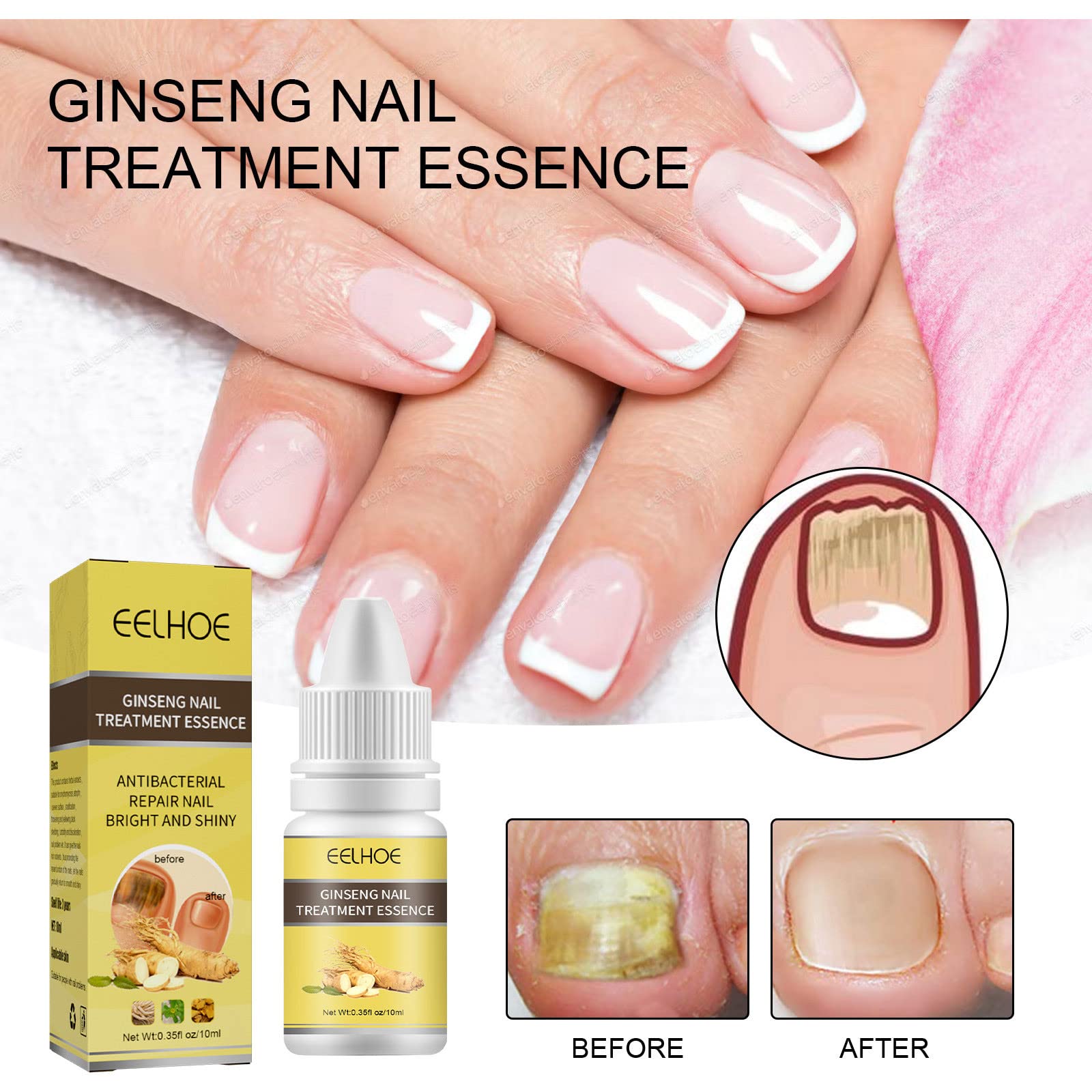10ml Ginseng Nail Treatment - Herbal Hand & Foot Whitening Cream for Cracked, Rough, Brittle Nails - Natural Nail Care Solution for Toe & Finger Nails - Perfect for Pedicures, Manicures & At-Home Nail Care Routines