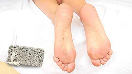 Natural Lava Pumice Stone for Dead Skin Removal - Callus Remover for Feet, Heels, Hands & Elbows | Exfoliating Pedicure Tool for Dry Skin - White Square Shape (Pack of 1) - Perfect for Home Spa, Pedicures & DIY Foot Care