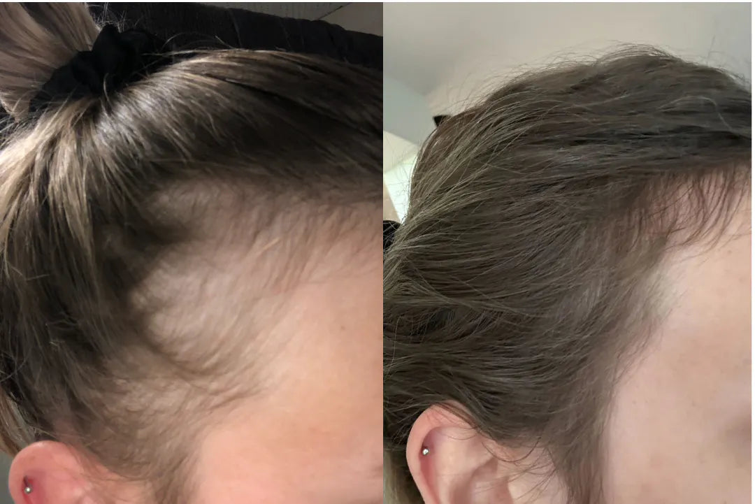 BioGro Hair Growth Serum by Pump Haircare - 50ml for Thicker, Stronger Hair - Perfect for Daily Use & Scalp Treatment