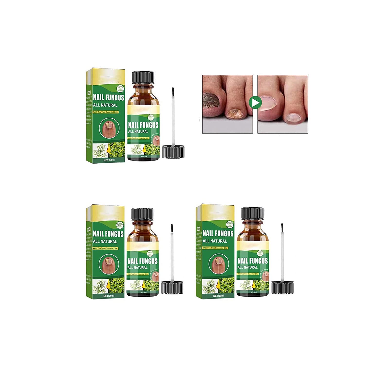 Extra Strength Toenail Fungus Treatment - 30ML Nail Renewal Liquid for Damaged, Cracked & Discolored Nails | Fast-Acting Nail Repair Solution for Fungal Infections | Podiatrist-Recommended for Toenail Restoration (3-Pack) - Ideal for Athletes, Swimmers & Active Lifestyles