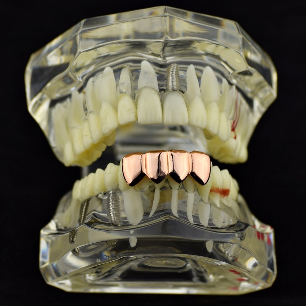 14K Rose Gold Plated Hip Hop Grillz - 4 Tooth Lower Quad Teeth Grills for Men & Women - Perfect for Rap Performances, Music Videos, and Streetwear Fashion