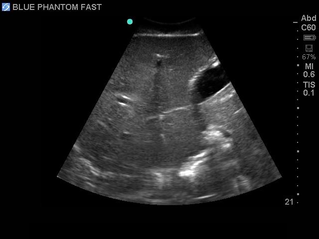 FAST Exam Real Time Ultrasound Training Model - Transthoracic Only for Emergency Medicine & Trauma Assessment Practice (Medical Simulation, Sonography Education, TTE Training)