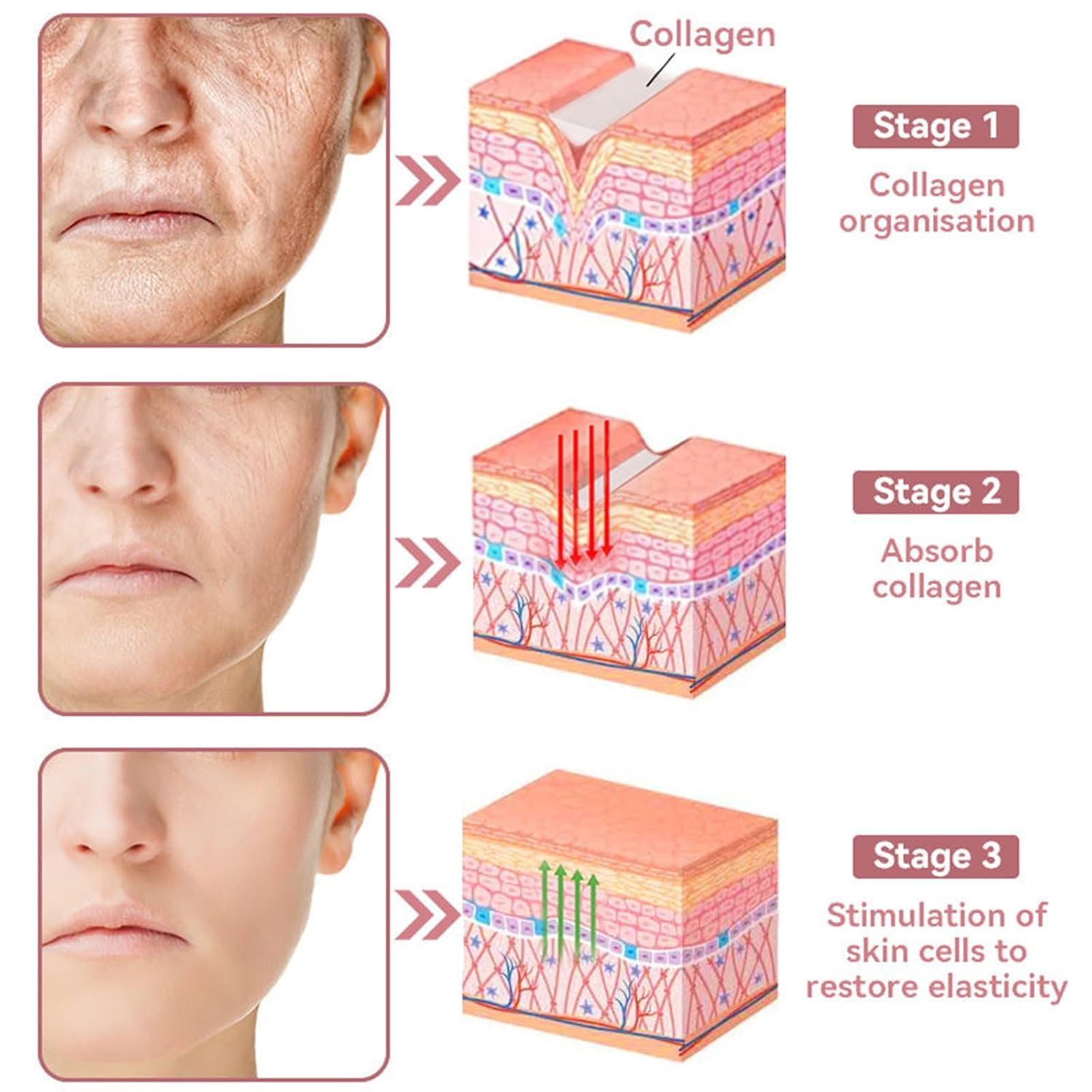 Coenzyme Q10 Collagen Jelly Cream - Intense Moisturizing Skin Care for Daily Use