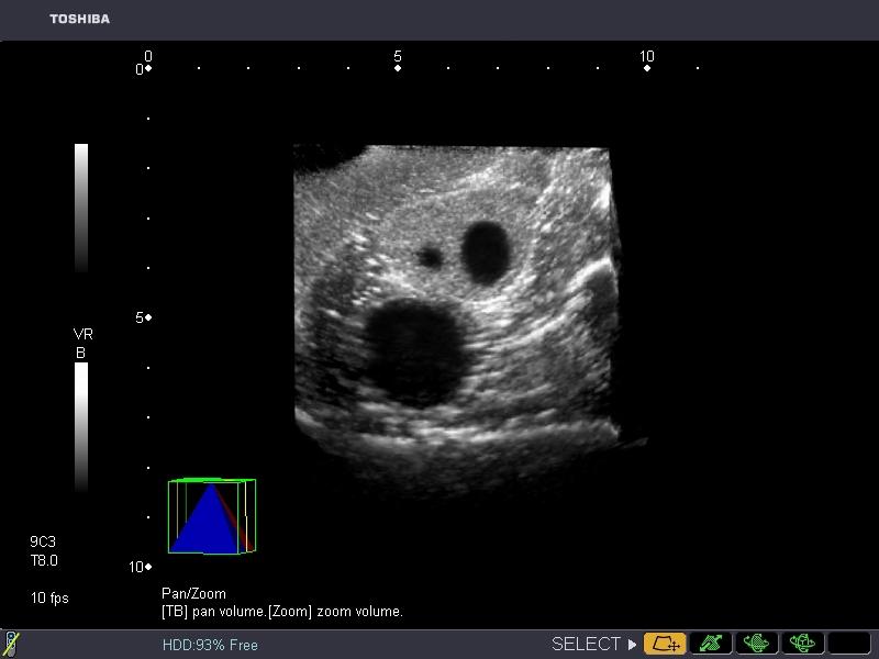 General Pathology Transvaginal Ultrasound Training Model - High-Quality Medical Simulation for OB/GYN Education & Clinical Practice - Perfect for Medical Schools, Hospitals & Diagnostic Labs