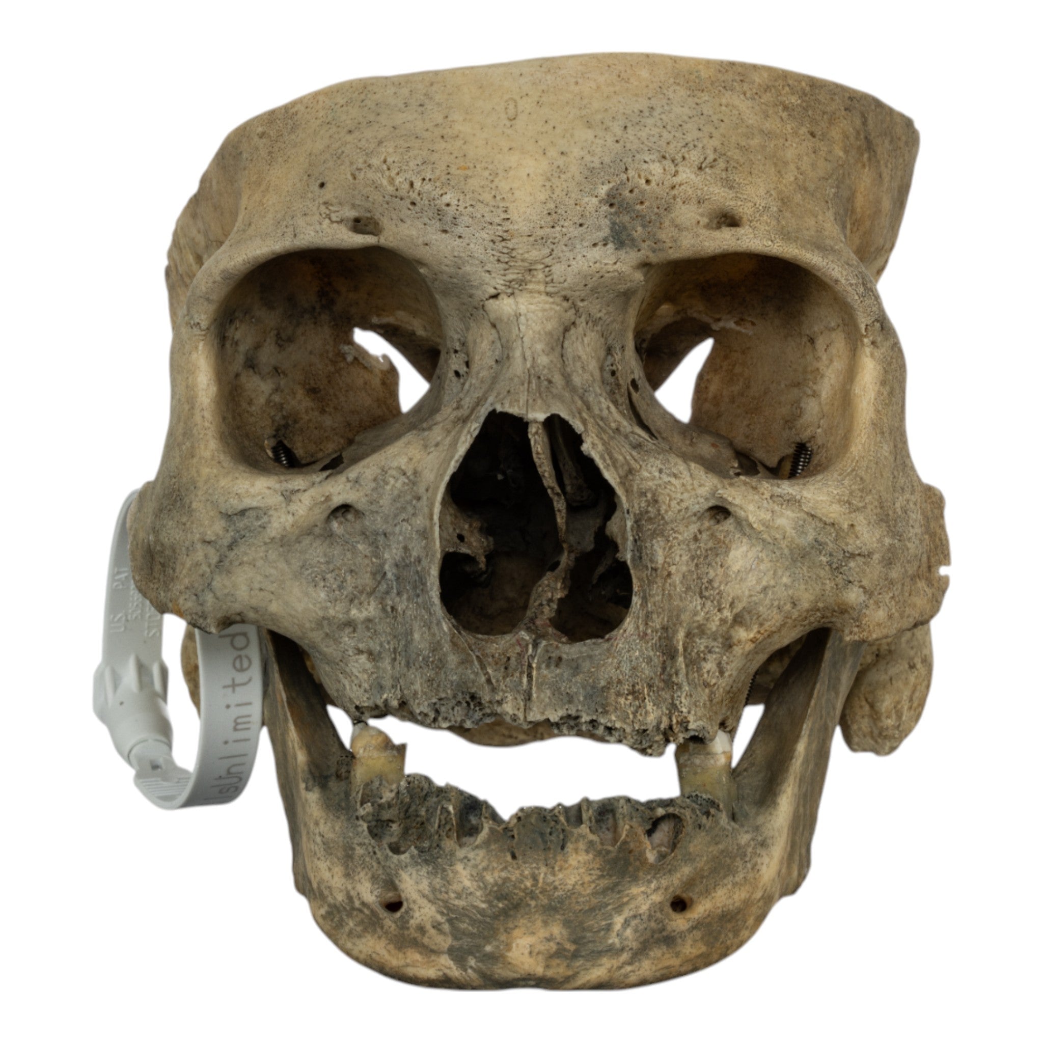 Authentic Real Human Skull for Medical Study & Halloween Decor - Perfect for Anatomy Education, Horror Props, and Gothic Home Decor