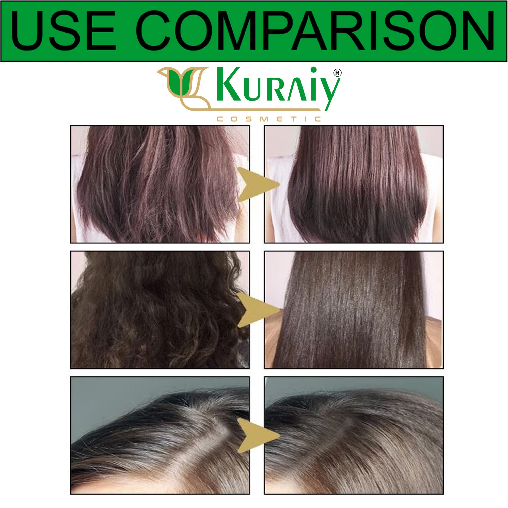 KURAIY® Aloe Vera Shampoo and Conditioner Set for Hair Loss Control & Healthy Hair Growth - Paraben Free, Silicone Free - 400ml (2 Pack) | Gentle Daily Hair Care for Men & Women with Thinning Hair or Scalp Irritation