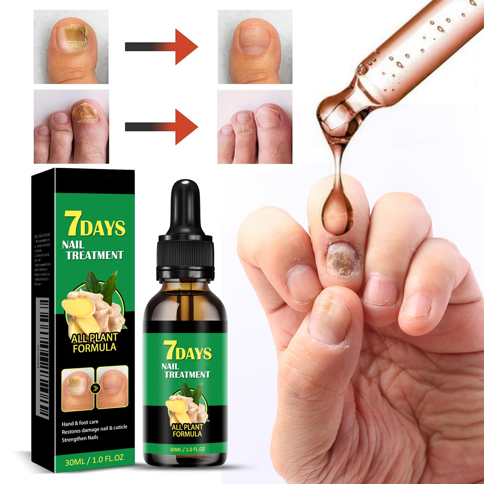 7Days Ginger Nail Growth Treatment Oil - Multi-Purpose Nail Repair & Strengthener Serum with Nutrients | For Brittle, Weak Nails & Cuticle Care | Perfect for At-Home Manicures & Nail Salon Use