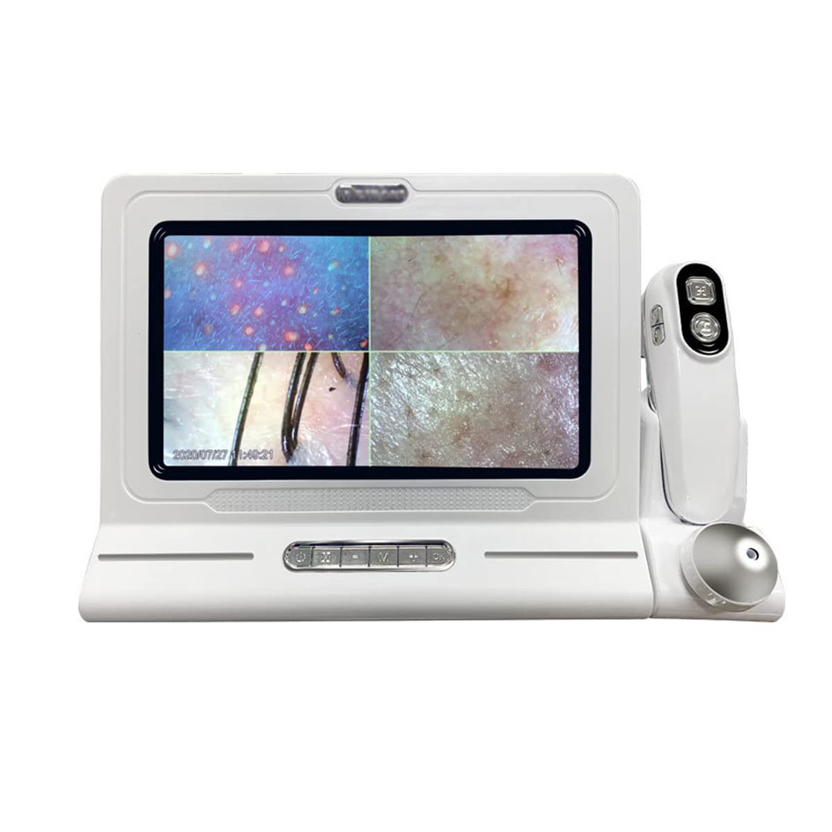 QETU Professional Skin & Hair Detector - 11 Inch HD LCD Screen for Scalp Analysis, Hair Follicle Moisture & Skin Pores Inspection | Portable Magnifying Analyzer for Dermatologists, Salons & Home Skin Care (Ideal for Acne, Blackhead & Pigment Detection)