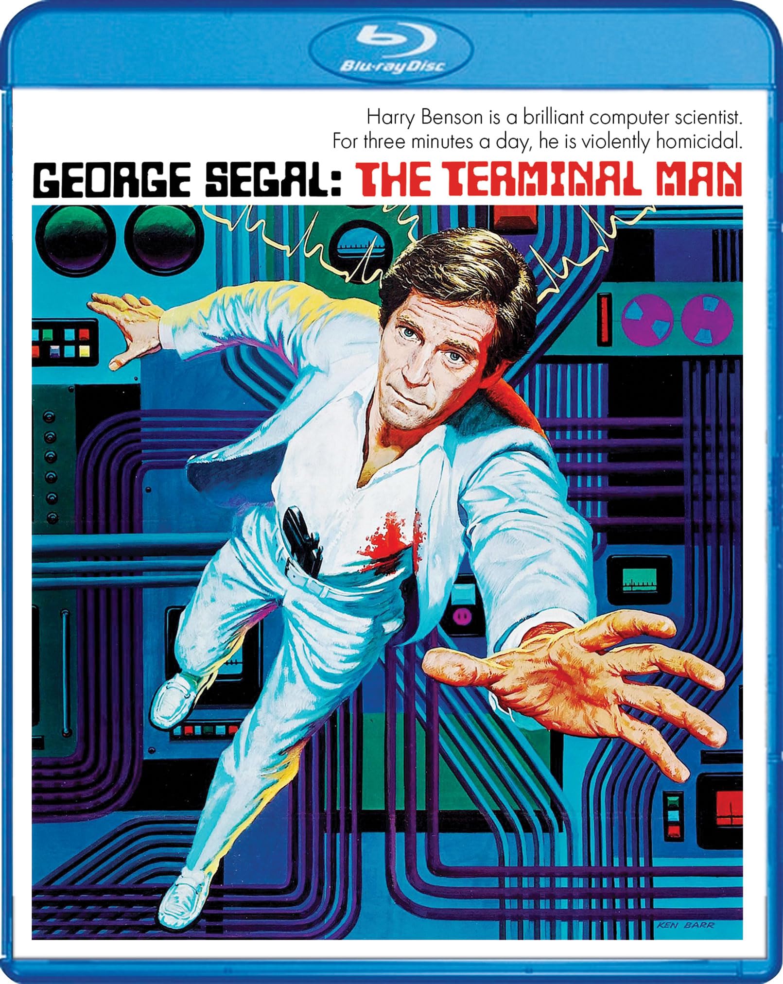 The Terminal Man Blu-ray - Classic Sci-Fi Thriller Movie for Home Theater & Movie Night Entertainment