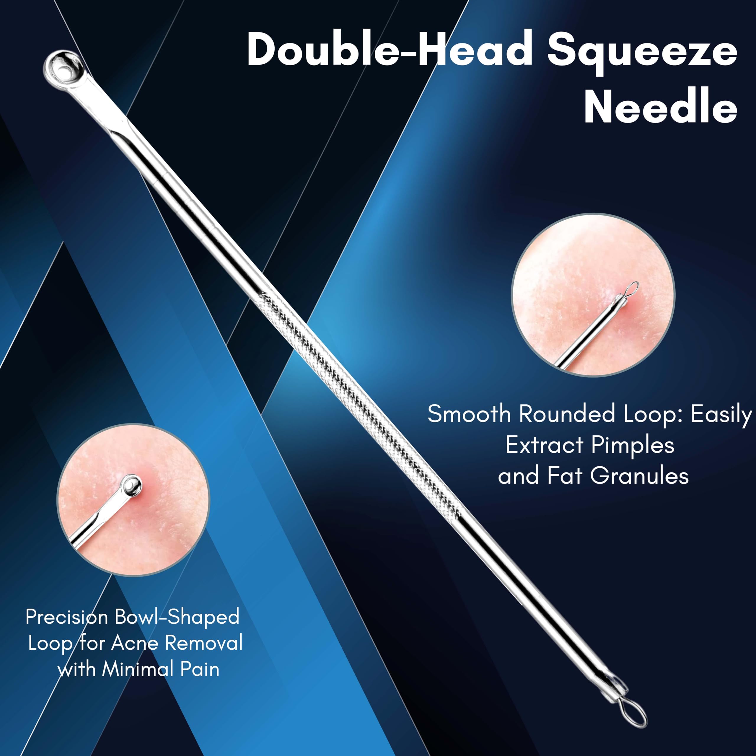 Beauté Secrets Blackhead & Acne Removal Kit - 4 Piece Stainless Steel Comedone Extractor Tools for Face & Nose - Pimple Popper Set for Women & Men - Perfect for Home Skincare & Blemish Treatment