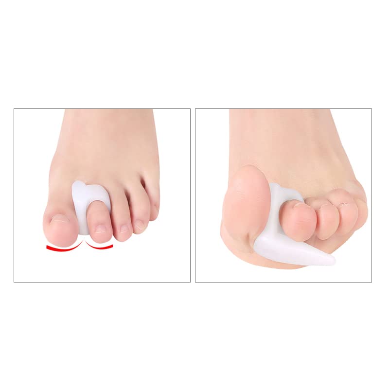 4 Pack Silicone Gel Toe Separators - Bunion Corrector & Hammer Toe Pain Relief for Women & Men - Comfortable Toe Spacers for Yoga, Running, Post-Surgery Recovery & Daily Wear