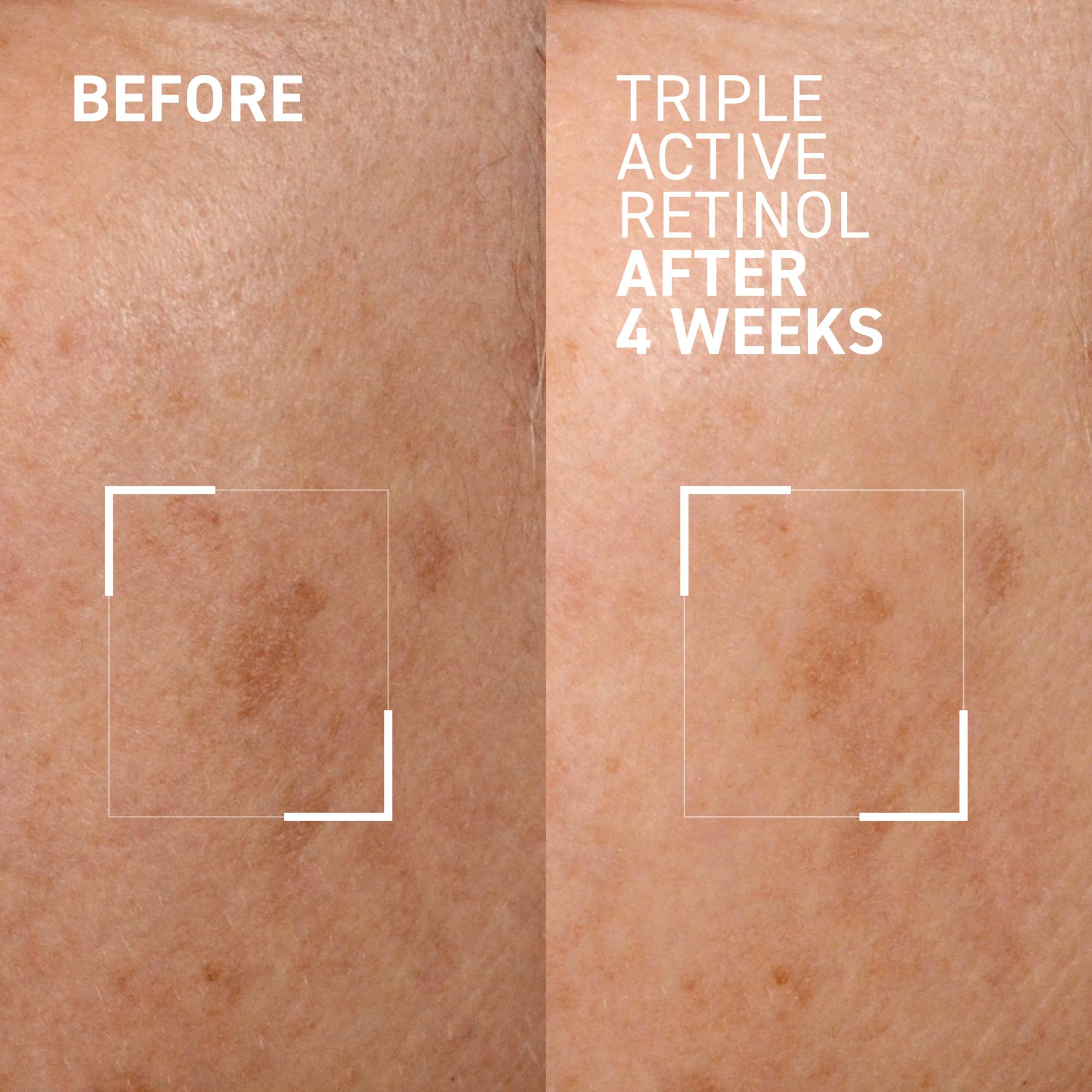 Dr. Brandt Bright This Way Triple Active Retinol Night Cream - Anti-Aging Face Moisturizer for Wrinkles & Dark Spots - Brightening & Hydrating Formula - 1 oz | Overnight Skin Renewal for Glowing Complexion