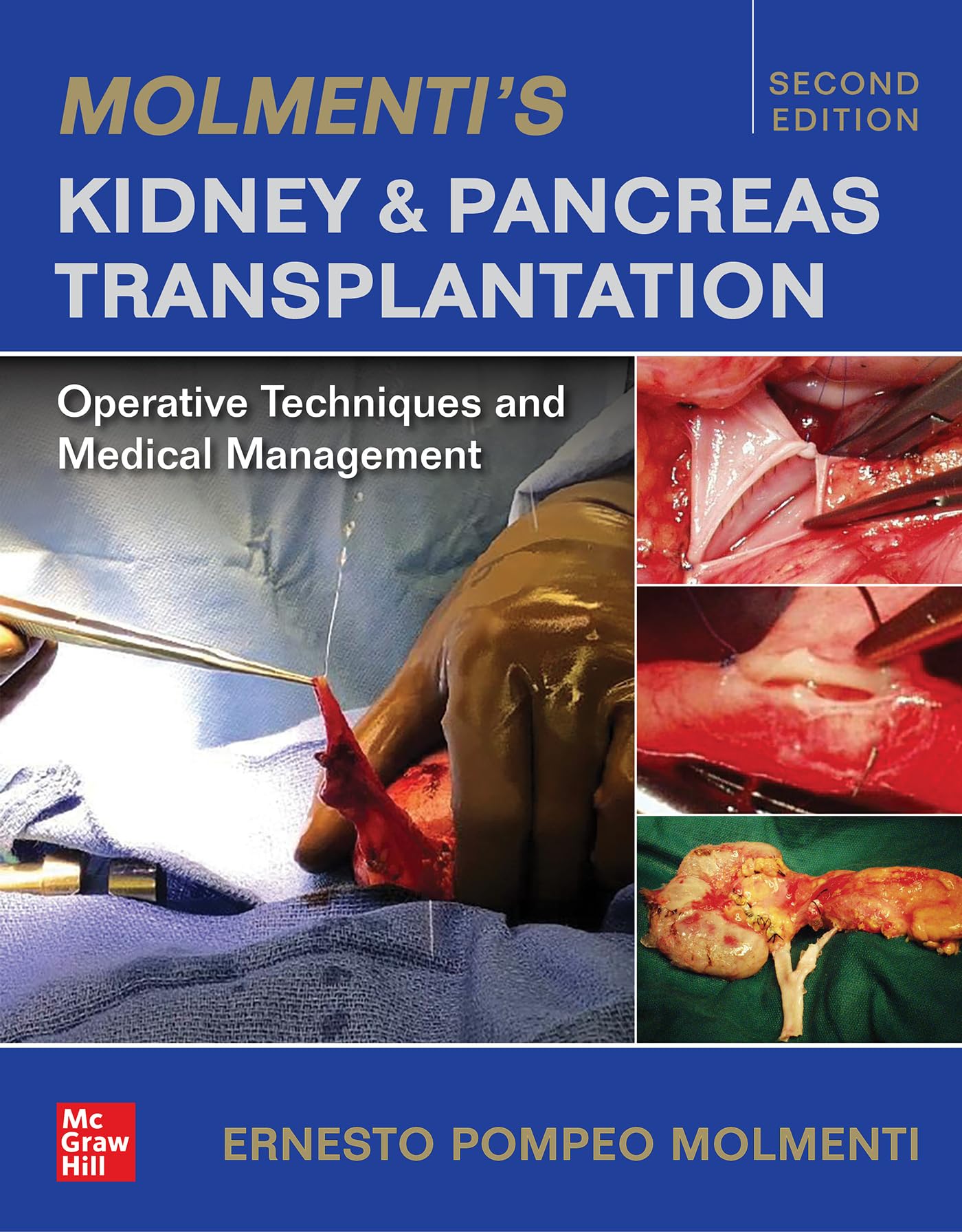 Molmenti's Kidney and Pancreas Transplantation: Surgical Techniques & Medical Care Guide | Essential for Transplant Surgeons & Nephrology Specialists