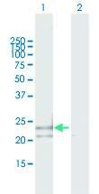 Anti-PSMB3 Mouse Polyclonal Antibody - 50μg for Western Blot & Immunoprecipitation - Research Use Only - H00005691-B02P