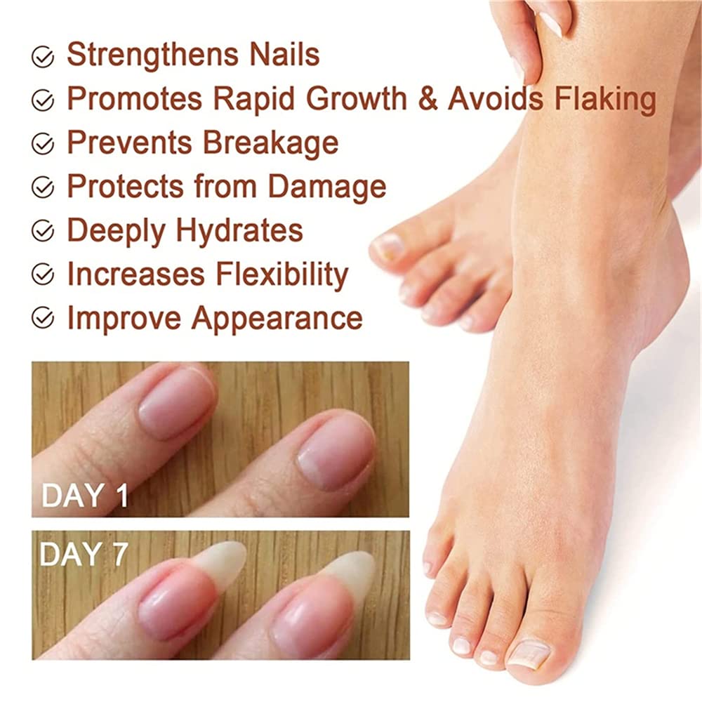 Pisheng 7-Day Nail Growth & Strengthening Serum - 20ml (2-Pack) | Fast Nail Treatment for Stronger, Healthier Nails | Perfect for Brittle Nails & Nail Care Routine
